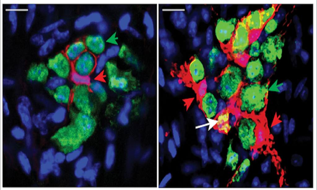 Indian Origin Scientists at Hopkins Discover Birth-And-Death Life Cycle of Intestinal Neurons