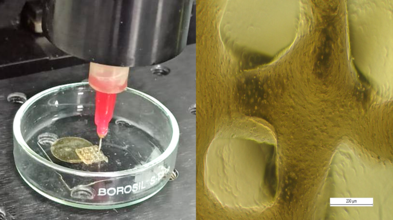 3D-Printed Silk Implant Regenerates Cartilage In Osteoarthritic Rat Knees